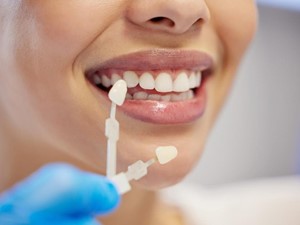 ¿Cada cuánto se puede hacer un blanqueamiento dental?